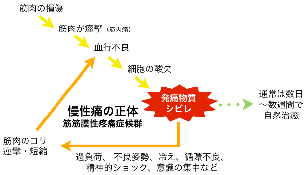 慢性痛の正体