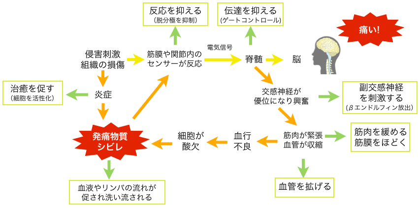 痛みのメカニズム